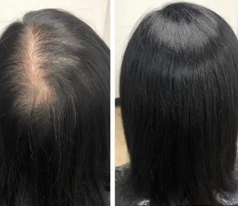 Before and after: visible scalp at the part to full coverage